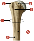 Figure d'un humérus où on identifie: 1. le col chirurgical, 2. le tubercule mineur, 3. le tubercule majeur, 4. le sillon intertuberculaire, 5. la crête du tubercule majeur, et 6. la crête du tubercule mineur