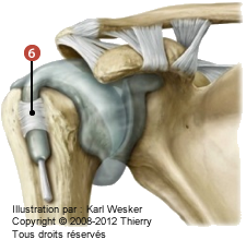 Figure de l'articulation scapulo-humérale où on identifie le ligament suivant: 6. Transverse.