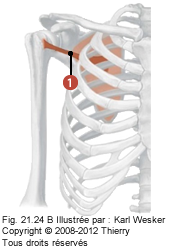 Figure où on identifie: 1. La couche musculaire subscapulaire.