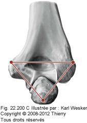 Figure du coude en extention, où les épicondyles et l'olécrâne forment un triangle.