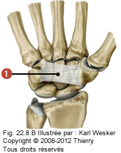 Figure 1 de 2 du canal carpien où on identifie: 1. Le rétinaculum des fléchisseurs.