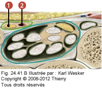 Figure 2 de 2 du canal de Guyon où on identifie: 1. Le nerf ulnaire, et 2. L'artère ulnaire.