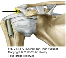 Figure de l'épaule, où on identifie l'espace sous-acromial.