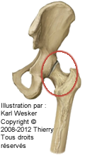 Figure 1 de 2 de l'articulation coxo-fémorale.