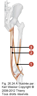 Figure 2 de 2 des ischios-jambiers où on identifie: 1. Les biceps-femoral, 2. Le semi-membraneux, et 3. Le semi-tendineux..