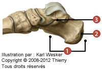 Figure du calcanéum en vue médiale où on identifie: 1. La tubérosité calcanénne, 2. Le sustentaculum tali, et 5. Le calcanéum.