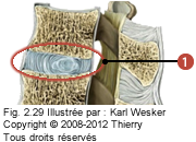 Figure de la région lombaire où on identifie: 1. Le disque intervertébral.